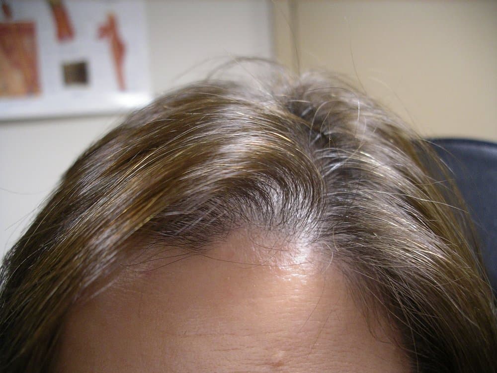 GenX Hair Growth Trichology - hair transplant in Scottsdale, AZ