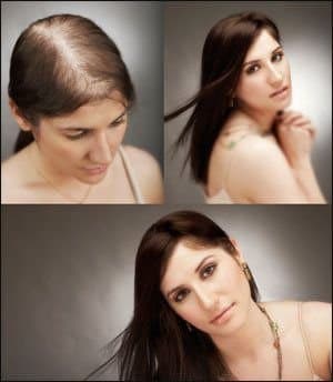 Rebel Hair Studio - hair transplant in Norwell, MA