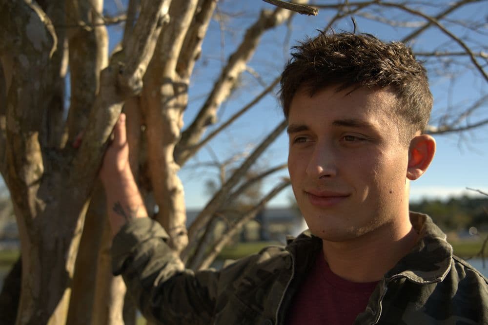 ManHair - hair transplant in Orange Park, FL