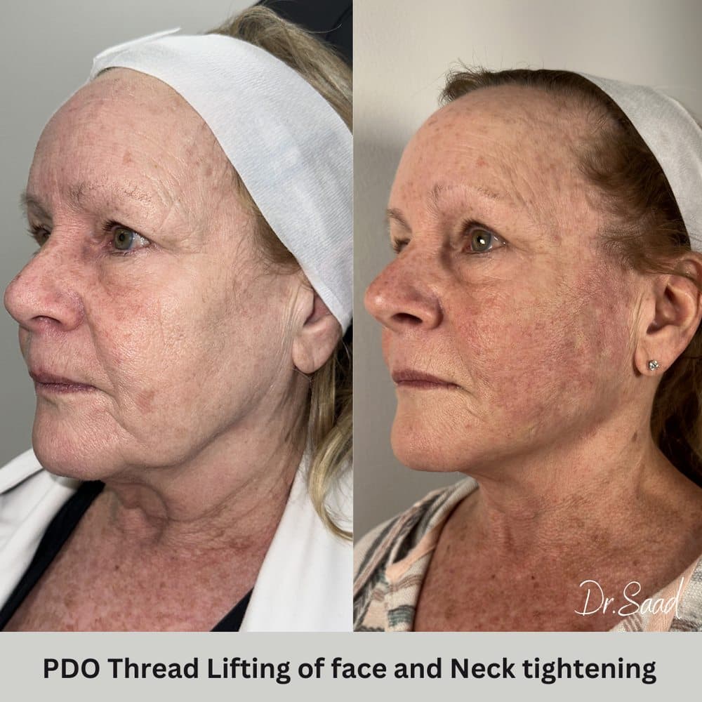 Healing Aesthetics - hair transplant in Hinsdale, IL