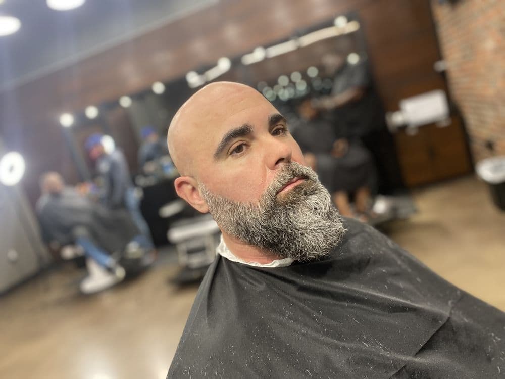 Urbarberjerry - hair transplant in Owings Mills, MD