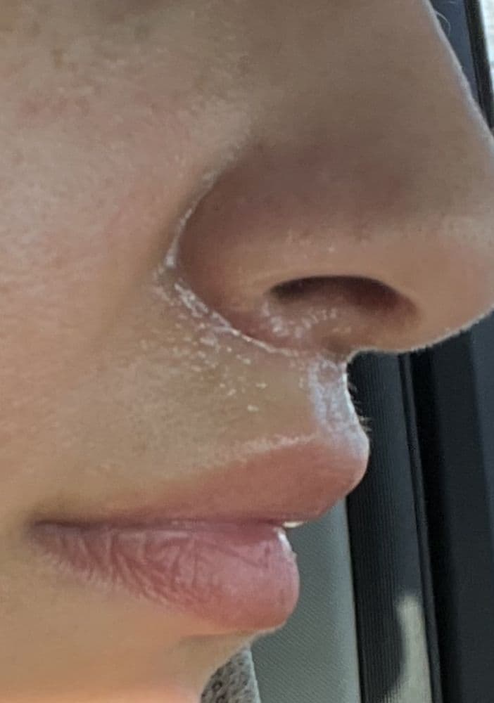 City Facial Plastics - hair transplant in New York, NY