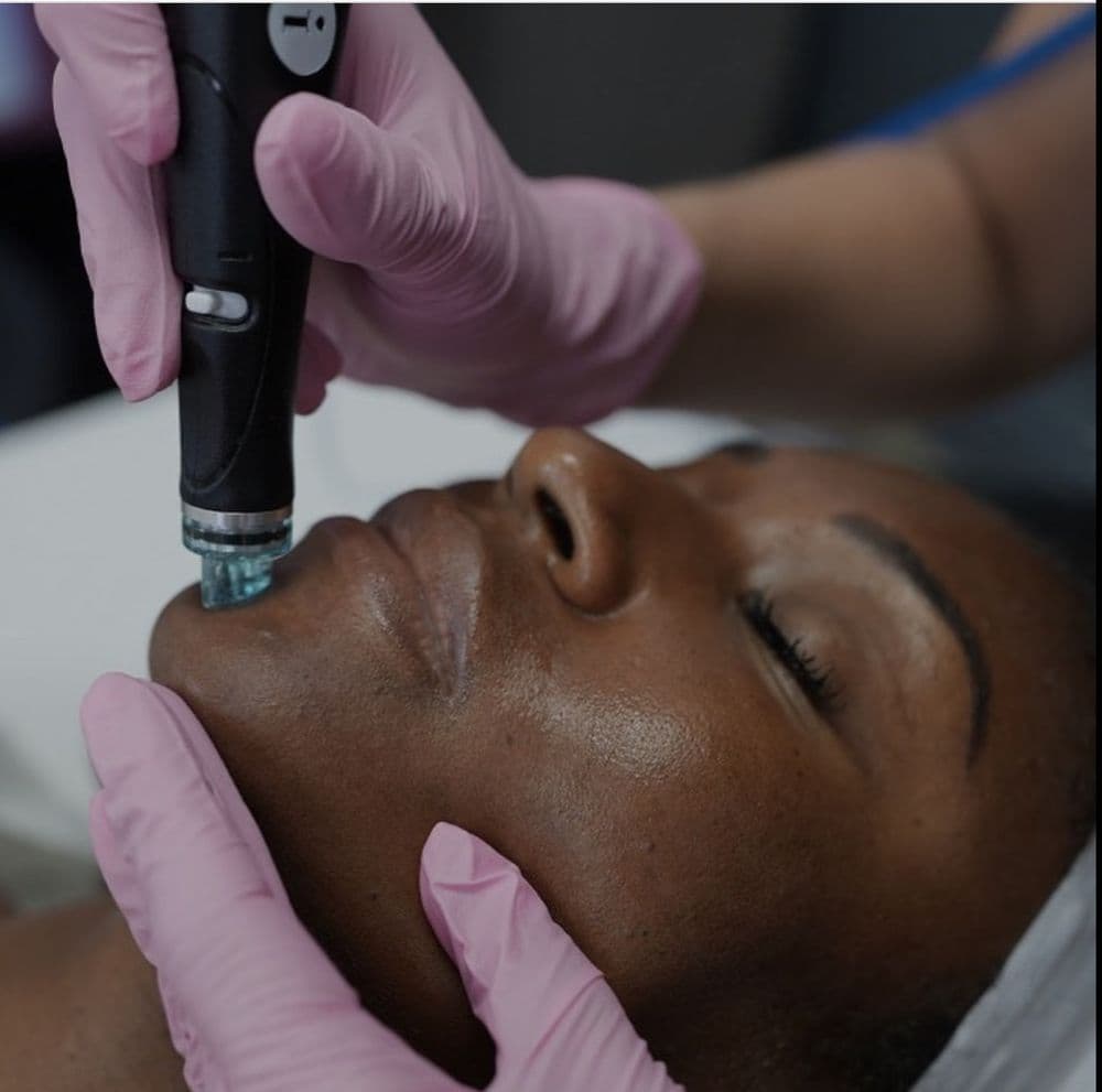 DREAM Aesthetics & Wellness Center - hair transplant in Franklin, WI
