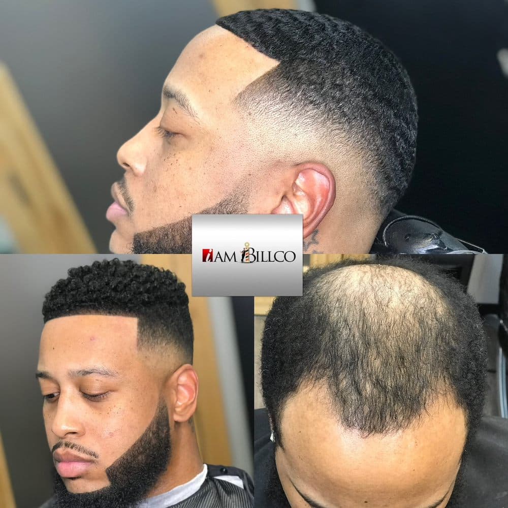 I Am Billco Hair Replacement Center - hair transplant in Houston, TX