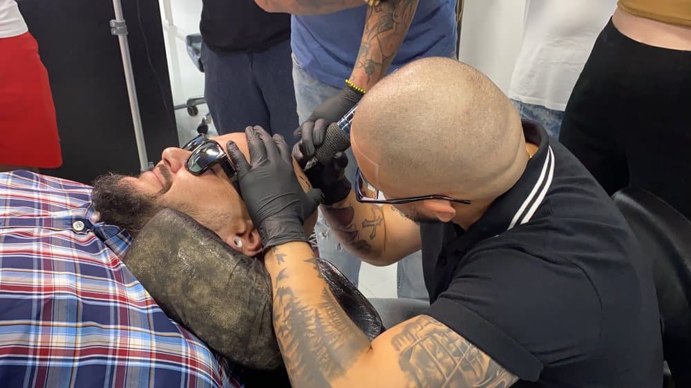 Evolution Solutions - hair transplant in Rogers, AR