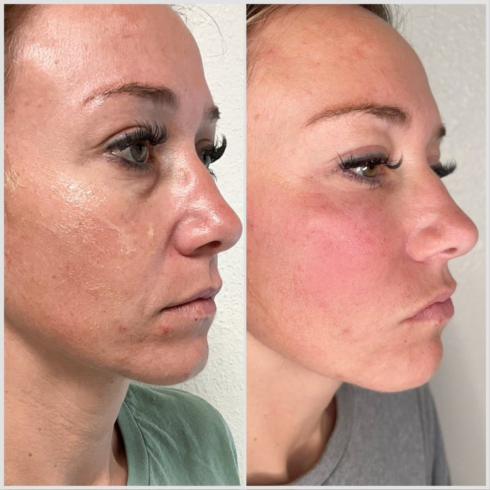 Jolie Medical Aesthetics - hair transplant in San Antonio, TX