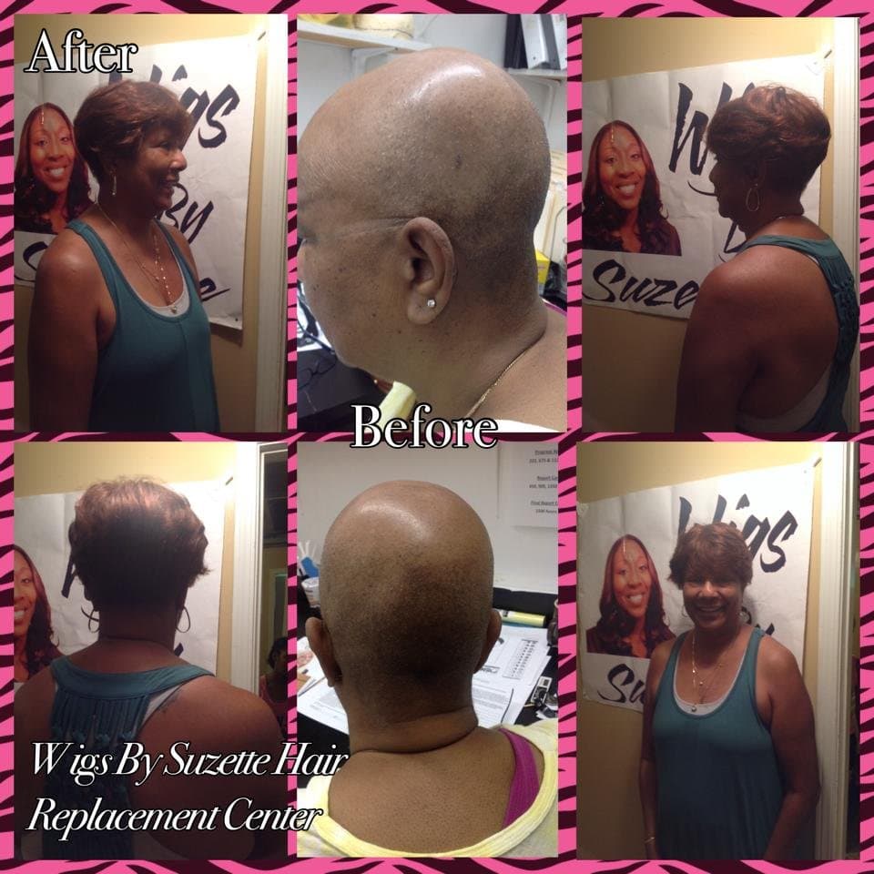 Wigs By Suzette Hair Replacement Center - hair transplant in Birmingham, AL