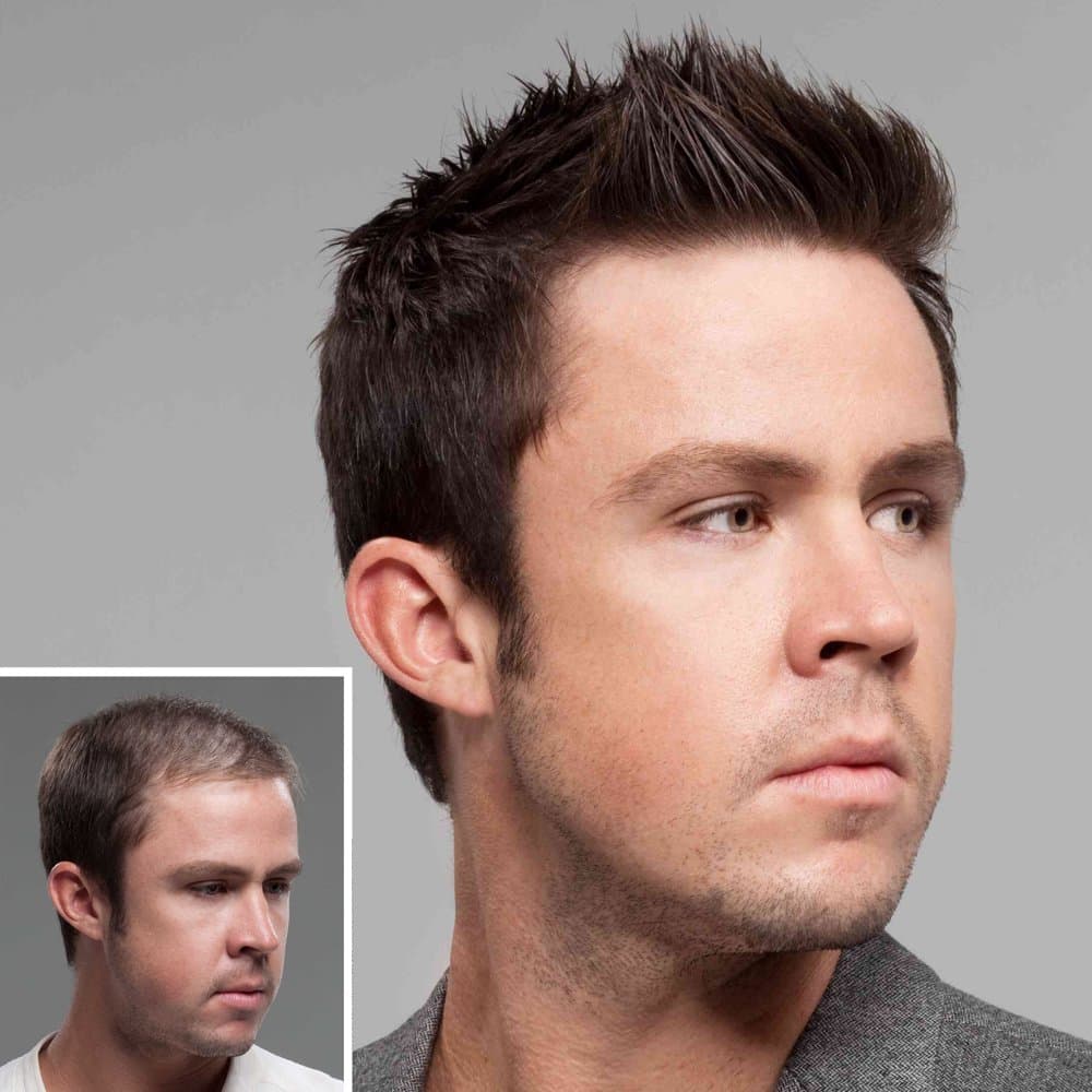 Life Like Hair Center - hair transplant in Las Vegas, NV