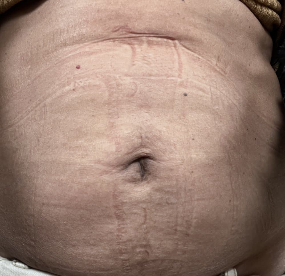 The Falcone Center - hair transplant in Bala Cynwyd, PA
