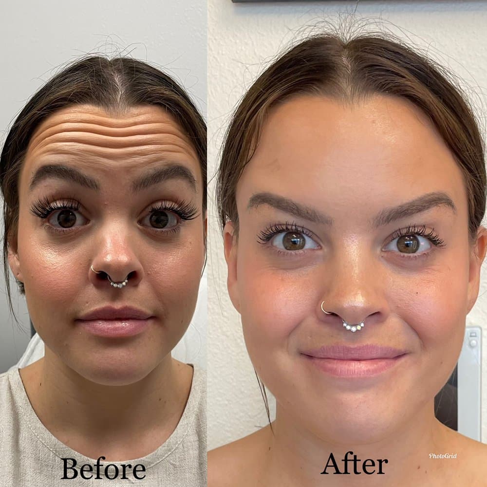 Bella Star Aesthetics - hair transplant in Thornton, CO