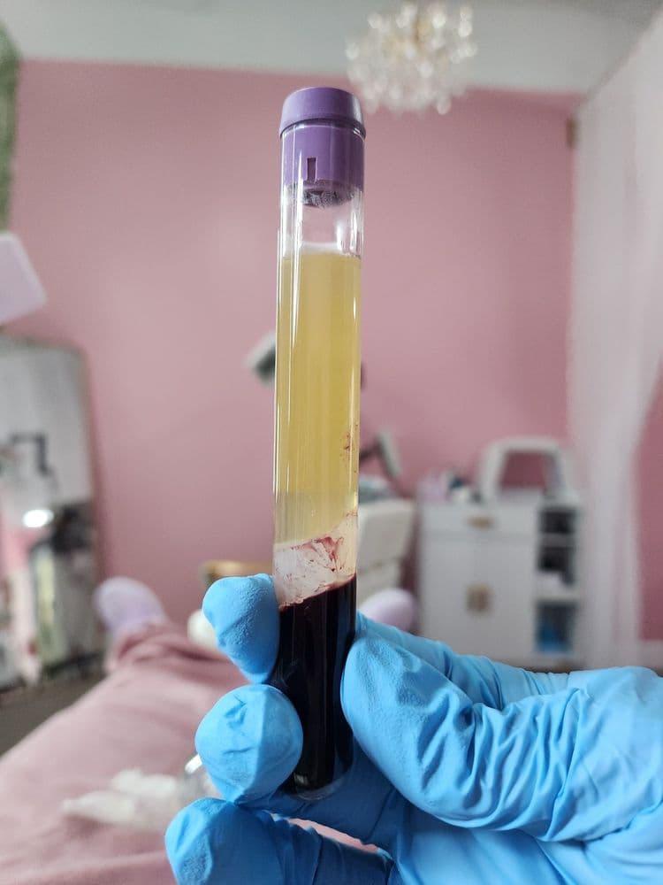 Summerz Spa - hair transplant in Miramar, FL