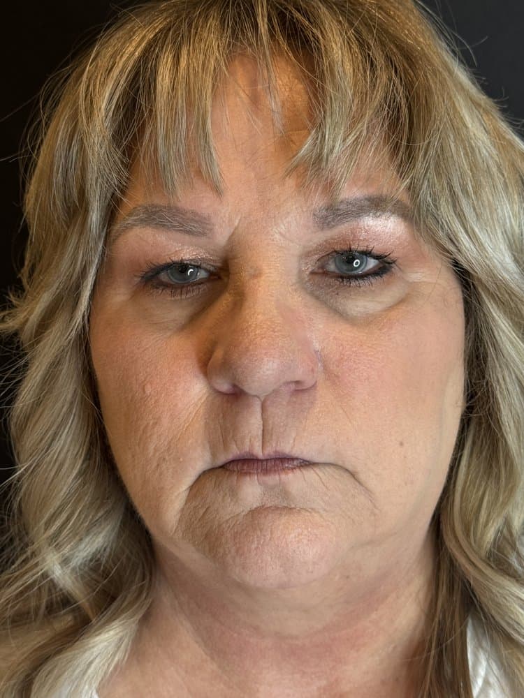 DS Skin & Lips Medical Spa - hair transplant in Scottsdale, AZ