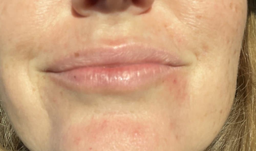 camoglam beauty - hair transplant in Sacramento, CA