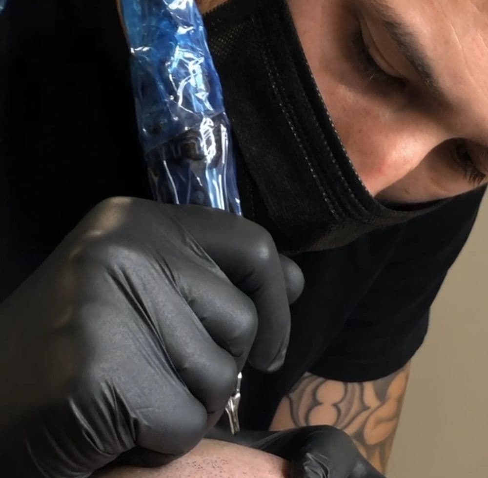 The Scalp Guru - hair transplant in Middleton, MA