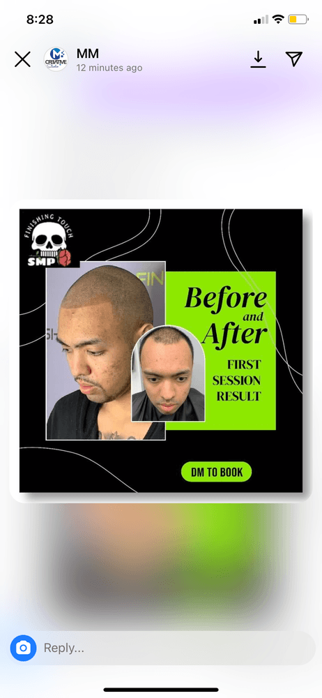 Finishing Touch Smp - hair transplant in Las Vegas, NV