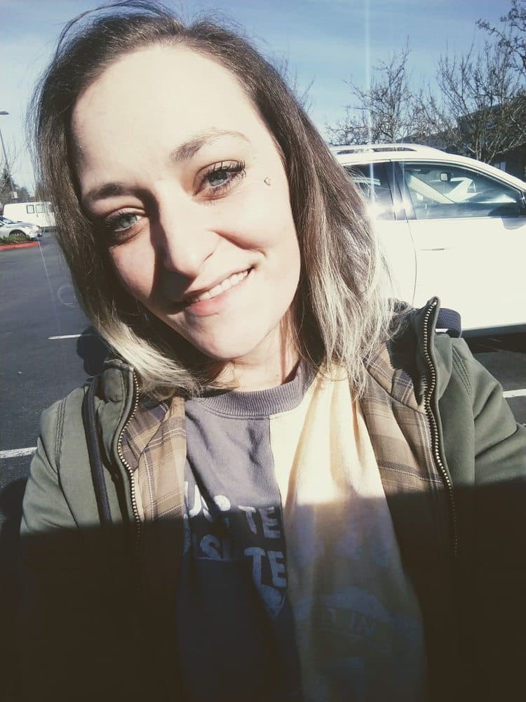 Abyssinia - hair transplant in Renton, WA