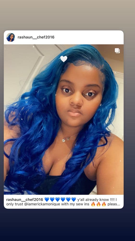 Erickamonique - hair transplant in Fleming island, FL