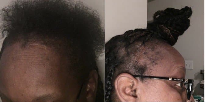 Essentials Of Eden - hair transplant in Houston, TX