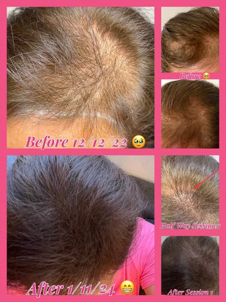 Scalp Society - Scalp Micropigmentation - hair transplant in Honolulu, HI