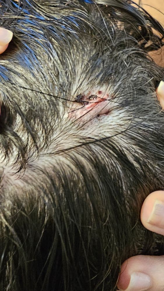 A to Z Dermatology - hair transplant in Chandler, AZ