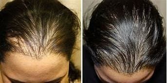 Selah Skin Care & Body Bar - hair transplant in Tampa, FL