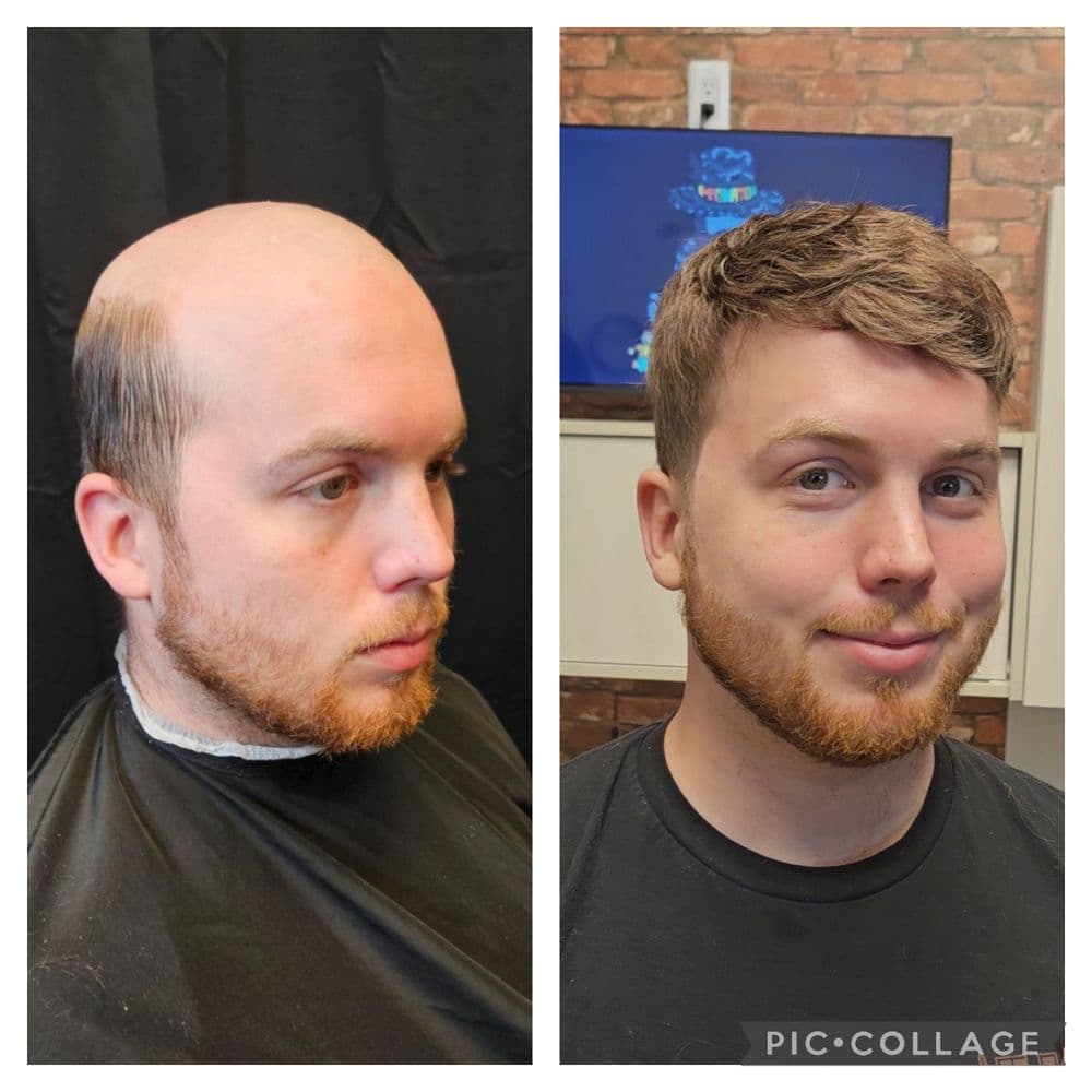 The Owl Barber - hair transplant in Ferndale, MI