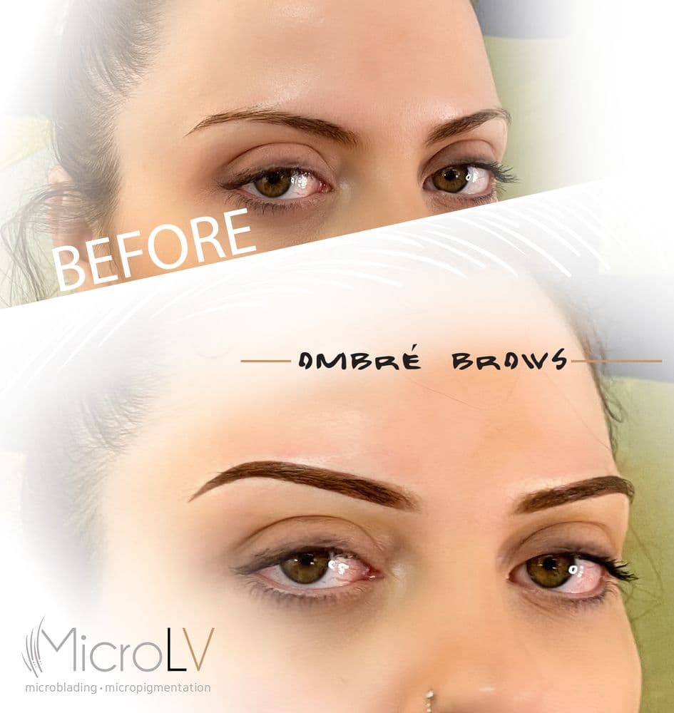 MicroLV Microblading - hair transplant in Las Vegas, NV