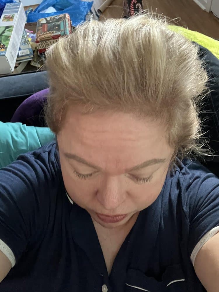 HPIHair Partners - hair transplant in Brentwood, TN