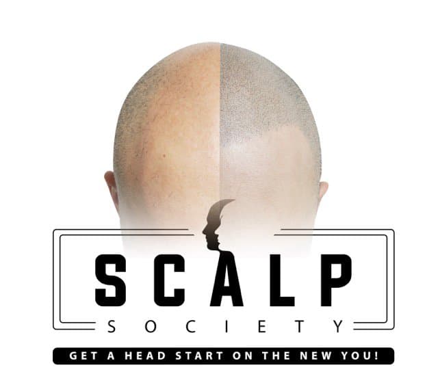 Scalp Society - hair transplant in San Francisco, CA