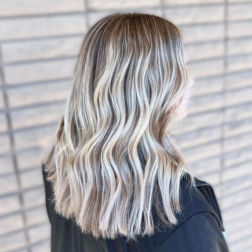 Operation Hair - hair transplant in San Jose, CA