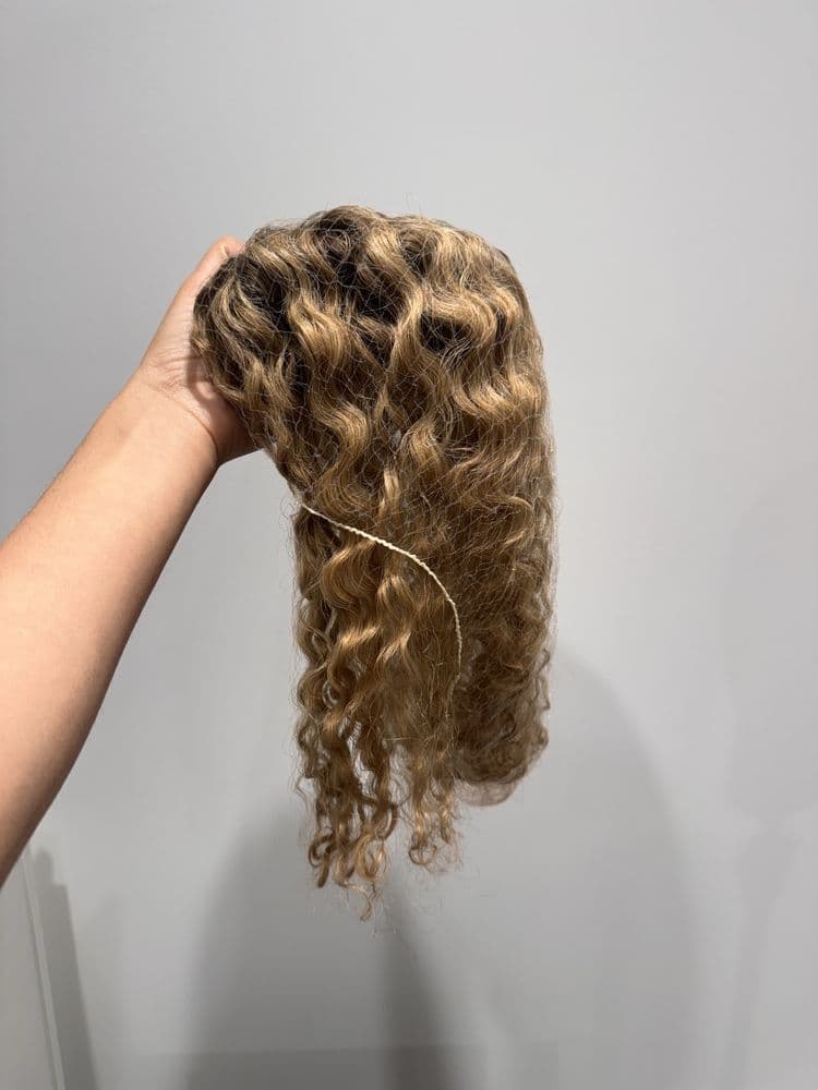 Kaelyss - hair transplant in Chicago, IL