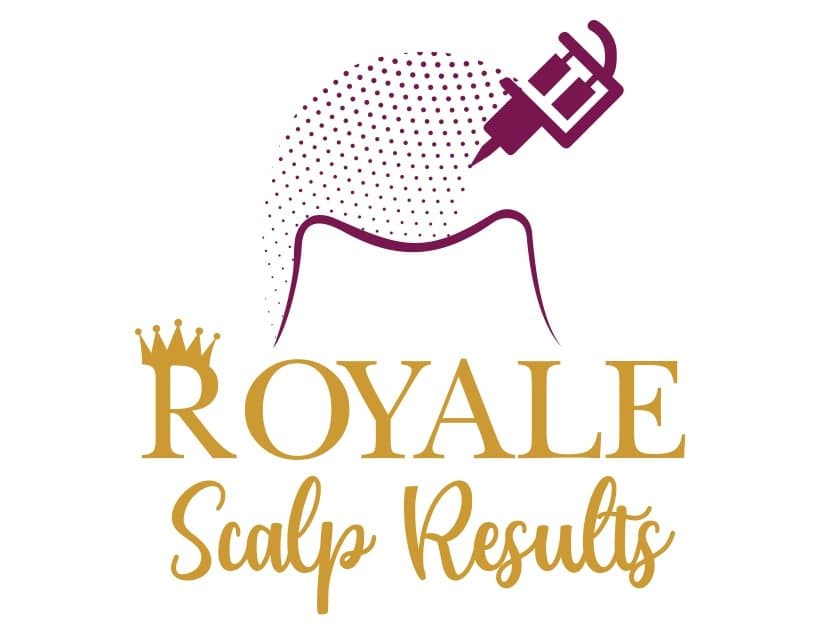 Royale Scalp Results - hair transplant in Houston, TX