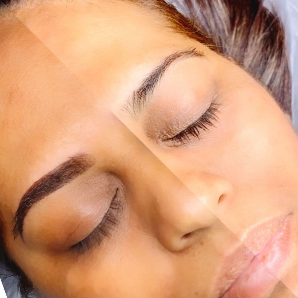 SD Ink Studio - hair transplant in San Diego, CA