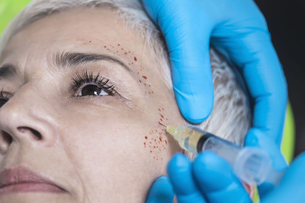 Golden PRP - hair transplant in Golden, CO
