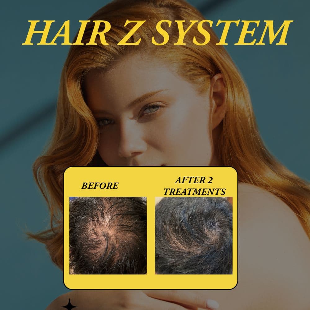 Hair Z System - hair transplant in Chicago, IL