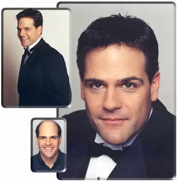 Apollo Hair Systems - hair transplant in Miami, FL