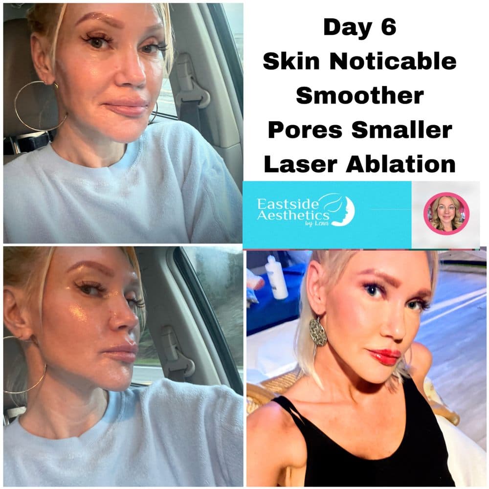 Eastside Aesthetics by Lena - hair transplant in Redmond, WA