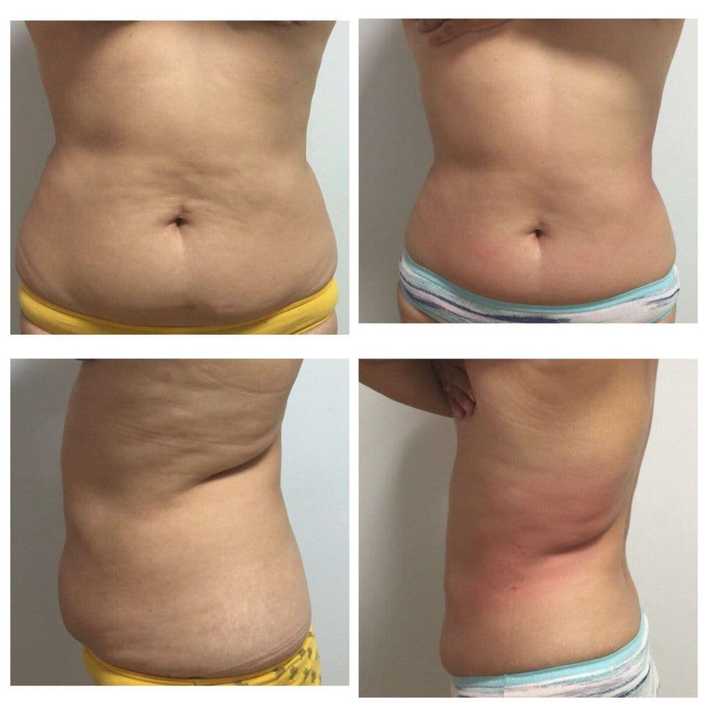 Lucca D'Vie Spa - hair transplant in Hallandale Beach, FL
