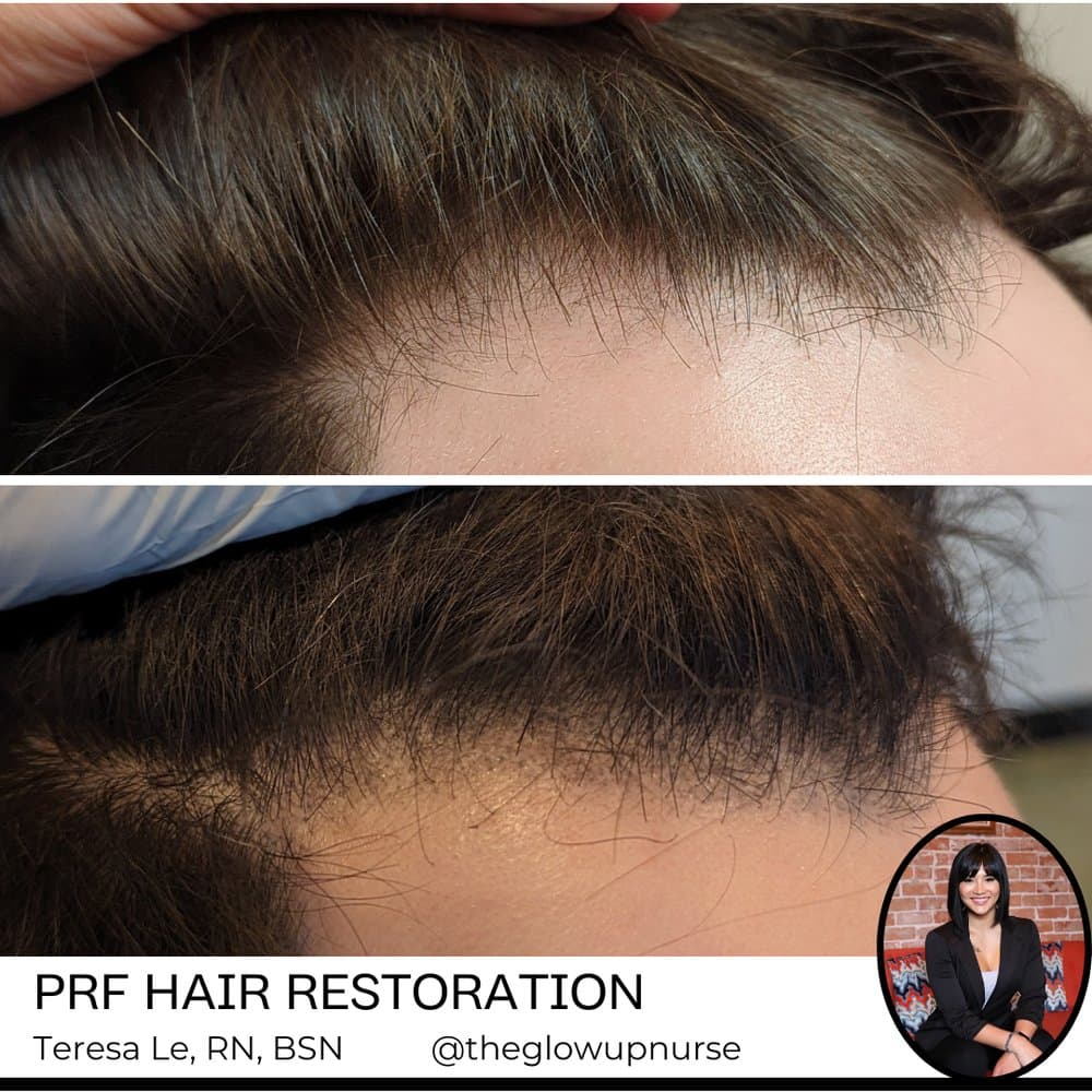 NaturaLe Medical Aesthetics - hair transplant in Goodyear, AZ