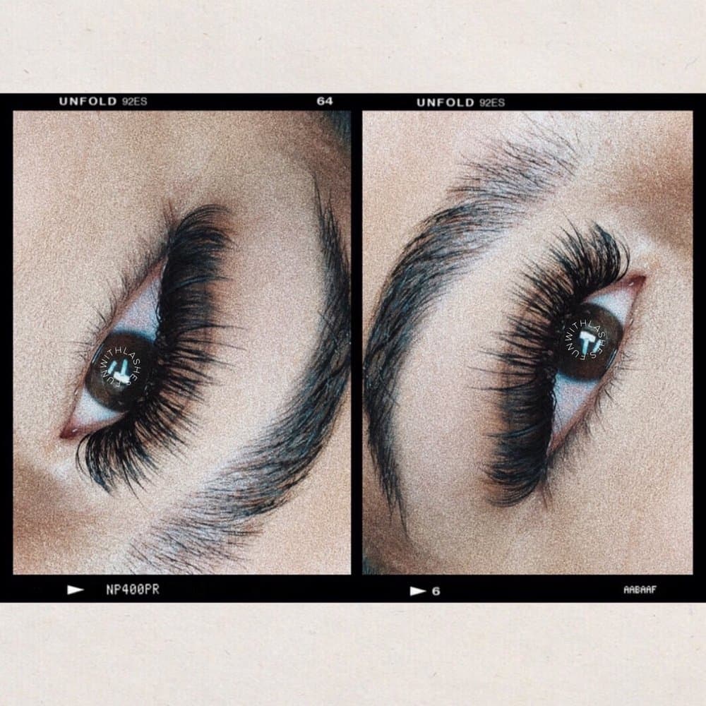 Fun with Lashes - hair transplant in San Antonio, TX