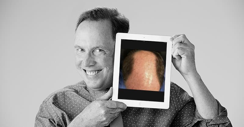 West+Bond Advanced Hair Restoration - hair transplant in Redwood City, CA