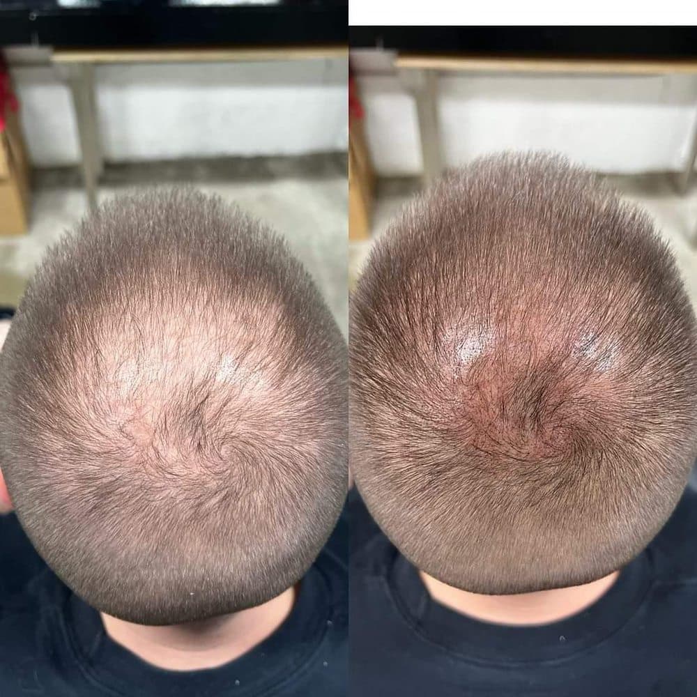 Romeo Beauty Hub - hair transplant in Jacksonville, FL