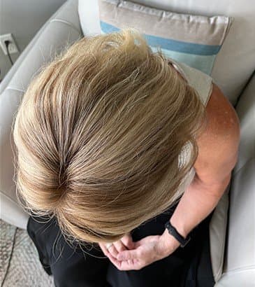 Sullivan Hairwear - hair transplant in Wichita, KS