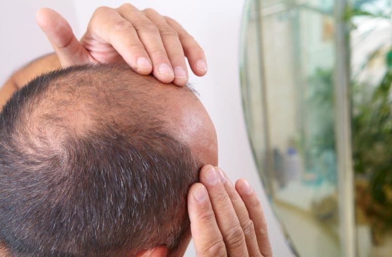 The Mane House - hair transplant in South Burlington, VT