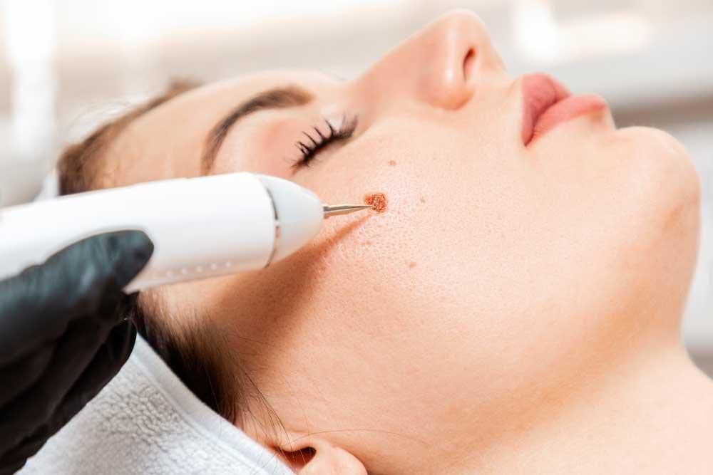 Precision Dermatology - hair transplant in Waterford, MI