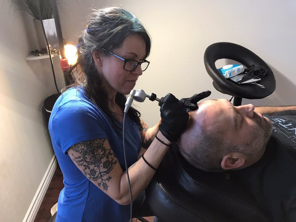 Alpha Micropigmentation - hair transplant in Las Vegas, NV