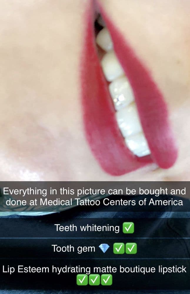 Medical Tattoo & Cosmetic Centers of America - hair transplant in Blaine, MN