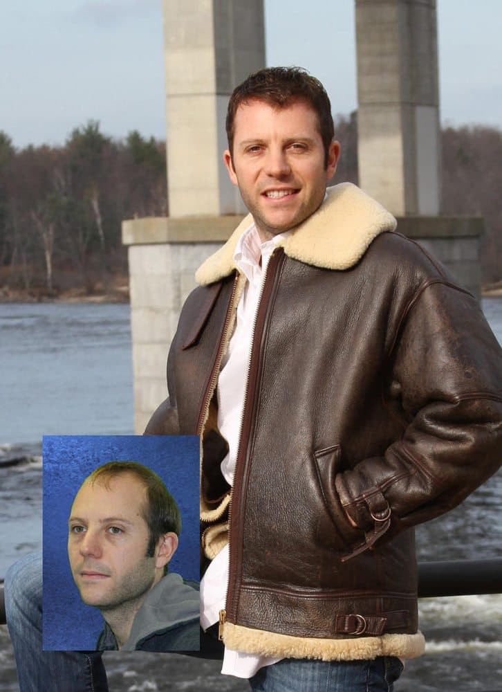 New England Associates - hair transplant in Manchester, NH