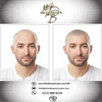 Mili's Beauty Studio - hair transplant in Austin, TX