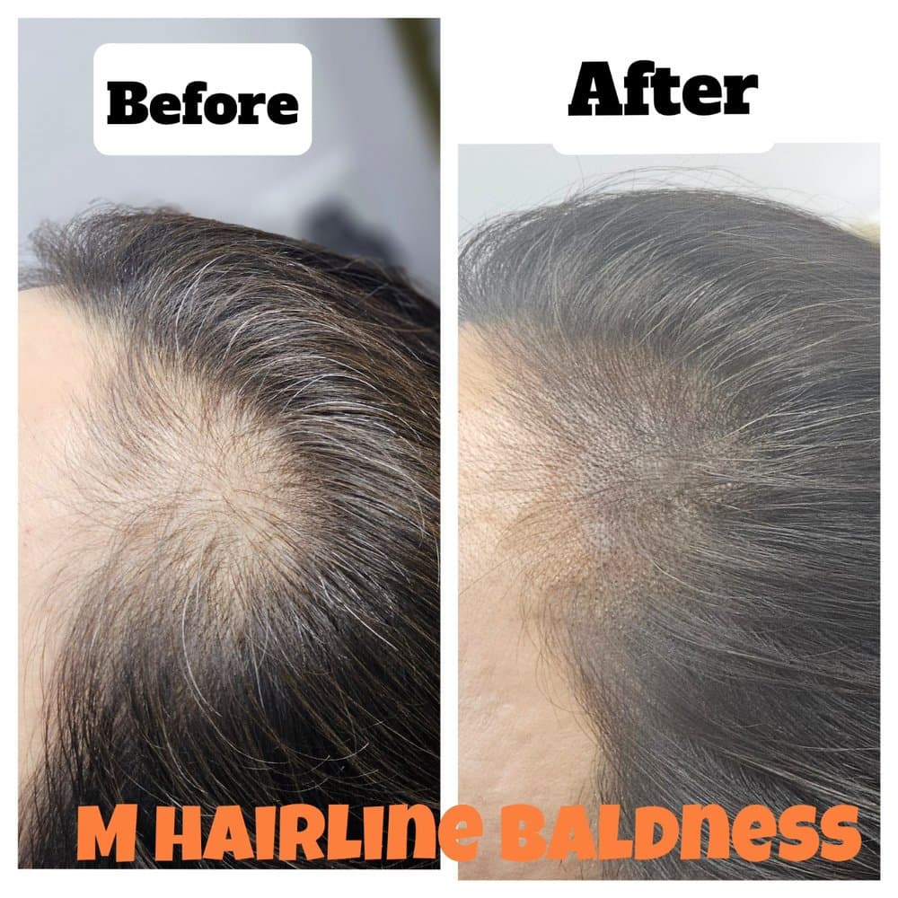 Grow on Scalp Care & Tattoo - hair transplant in Los Angeles, CA